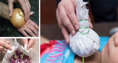 Hành tây không chỉ để ăn, mẹ có thể chữa 6 loại bệnh cho con nhờ chiêu rẻ tiền này - Ảnh 2.