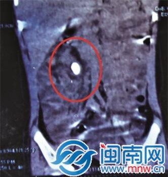 Mới 2 tuổi đã bị sỏi thận, bố mẹ chết lặng vì thực phẩm vàng ngày nào con cũng uống - Ảnh 1.