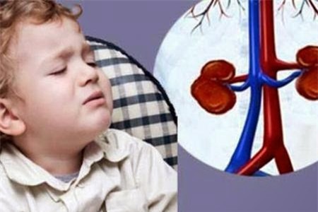 Mới 2 tuổi đã bị sỏi thận, bố mẹ chết lặng vì thực phẩm vàng ngày nào con cũng uống - Ảnh 3.