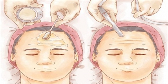 lam-dep-1-ngoisao.vn-w600-h300 3