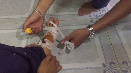 Hành trình “lật mặt” ăn xin đểu