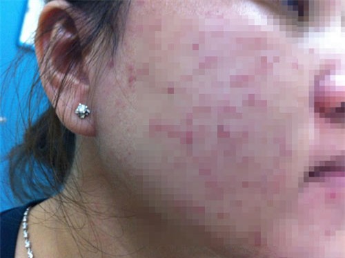 lam dep “khac nguoi”, co gai tre nhap vien voi khuon mat bien dang - 1