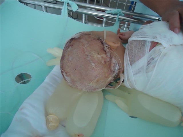 Nhân ái, từ thiện, nghèo khó, bệnh nặng