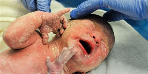 bac si chi ra 7 ly do khong nen tam cho tre ngay sau khi sinh - 1