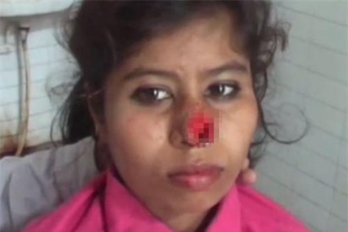 chong can dut mui vo vi gia dinh vo khong chiu dap ung yeu cau cua hoi mon - 1