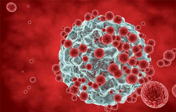 béo phì gây ung thư