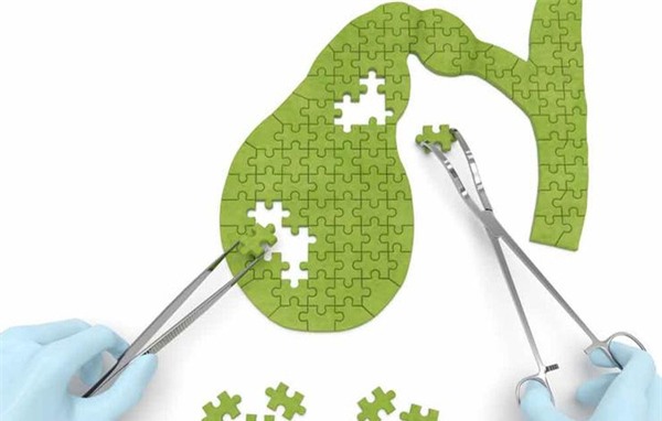 béo phì gây ung thư