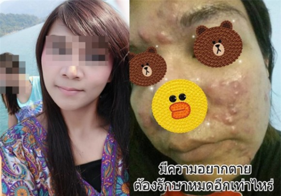 tác hại của kem trộn