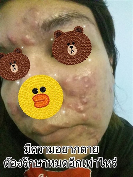 tác hại của kem trộn