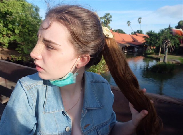 Vỡ mộng khi nhìn thấy hình ảnh nữ thần thoát tục của Thái Lan trước khi phẫu thuật thẩm mỹ - Ảnh 12.