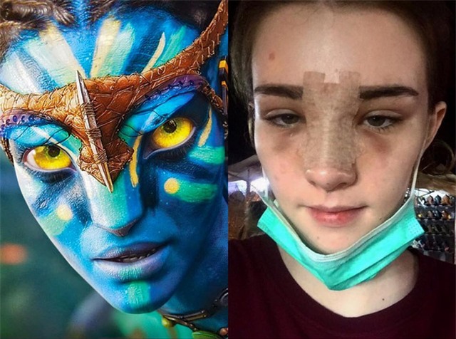 Vỡ mộng khi nhìn thấy hình ảnh nữ thần thoát tục của Thái Lan trước khi phẫu thuật thẩm mỹ - Ảnh 5.