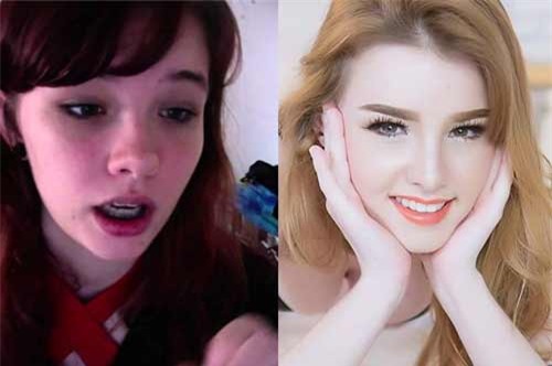 Vỡ mộng khi nhìn thấy hình ảnh nữ thần thoát tục của Thái Lan trước khi phẫu thuật thẩm mỹ - Ảnh 7.