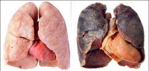Bài thuốc có một không hai cứu phổi người nghiện thuốc lá - Ảnh 1.