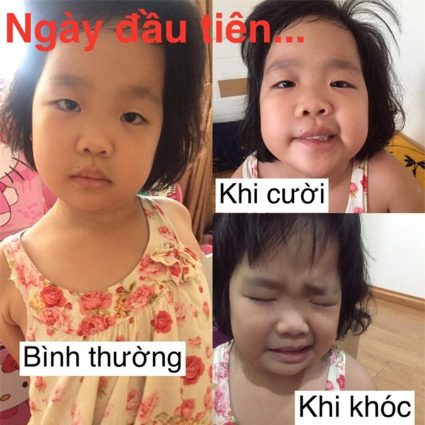 Hành trình 40 ngày lấy lại khuôn mặt cho con và cảnh báo cha mẹ nào cũng nên biết - Ảnh 1.
