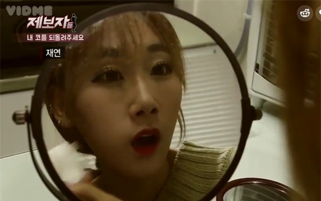 Phẫu thuật thẩm mỹ hỏng, cô gái Hàn Quốc nhận hậu quả đáng sợ - Ảnh 2.