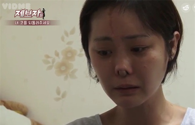 Phẫu thuật thẩm mỹ hỏng, cô gái Hàn Quốc nhận hậu quả đáng sợ - Ảnh 5.