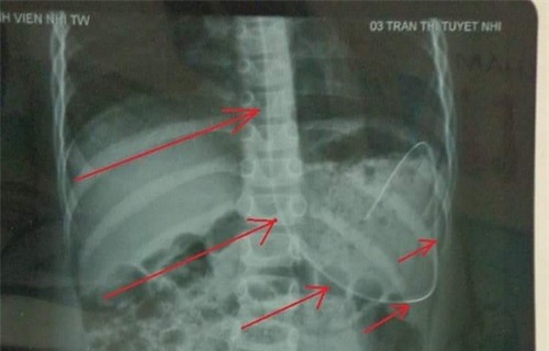 xot xa nguoi bo 'luc bat tong tam' nhin con gong minh chong bao benh - 3