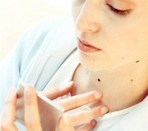 Image result for nốt ruồi ở cổ