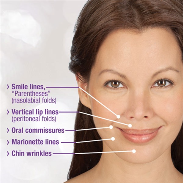 Image result for Laughter lines and wrinkles around your mouth