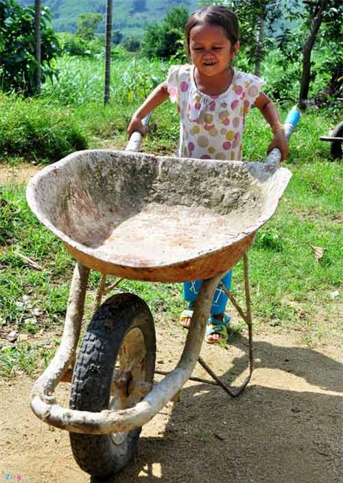 Cô gái 20 tuổi nặng 11 kg - 4