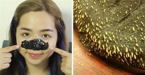 tu lam gel lot mun de loi bang sach tat ca mun cam, mun dau den tren mui - 4