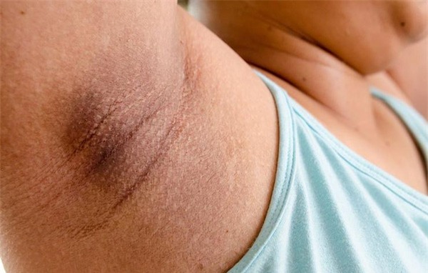 Dấu hiệu cảnh báo bạn đã mắc căn bệnh cứ 7 giây lại có 1 người tử vong trên thế giới - Ảnh 7.