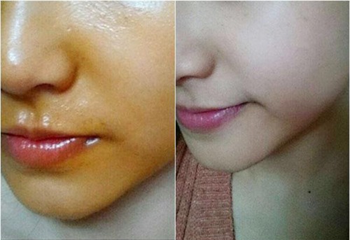 1 vien dau gac moi ngay, da ban se lang min khong ti vet - 2