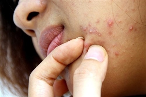 nan-mun-blogtamsuvn2