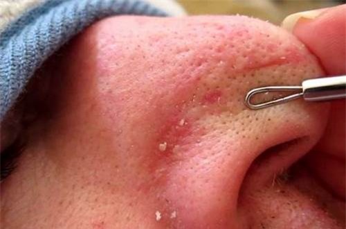 nan-mun-blogtamsuvn1