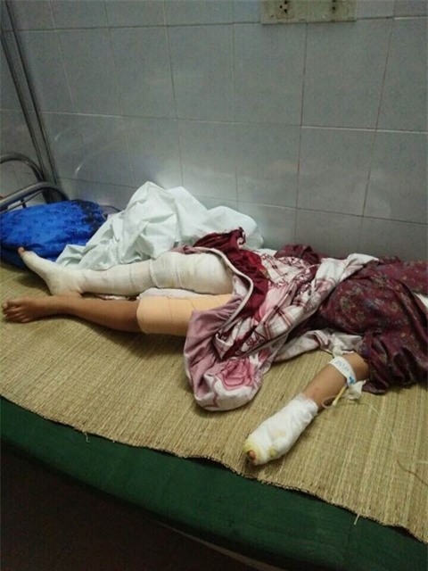 gay su voi hang xom, da vang chao mo khien 2 chau be bong nang hinh anh 1