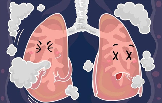 8 dấu hiệu cảnh báo phổi đang có vấn đề, bạn không được chủ quan! - Ảnh 1.