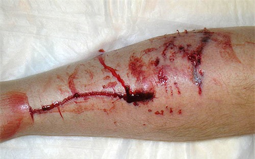 Sai lầm nuôi chó khiến chó hung dữ - ảnh 3