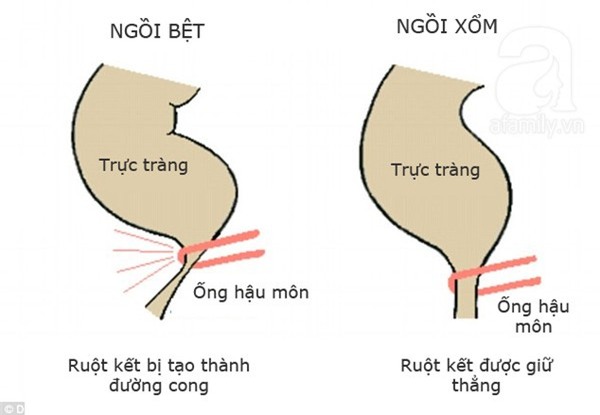 bệnh táo bón