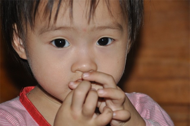 Hơn 2 tuổi, bé Như Quỳnh được xác định bị điếc sâu 2 tai và được chỉ định cấy điện cực ốc tai.