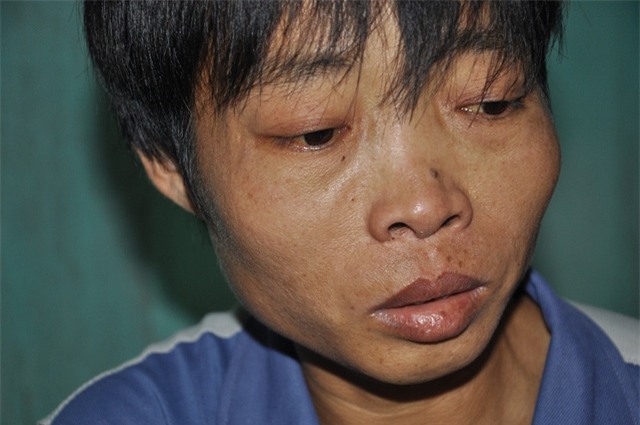 Bố bị tan máu bẩm sinh nhưng đã nhiều năm không có tiền lên viện chữa trị.