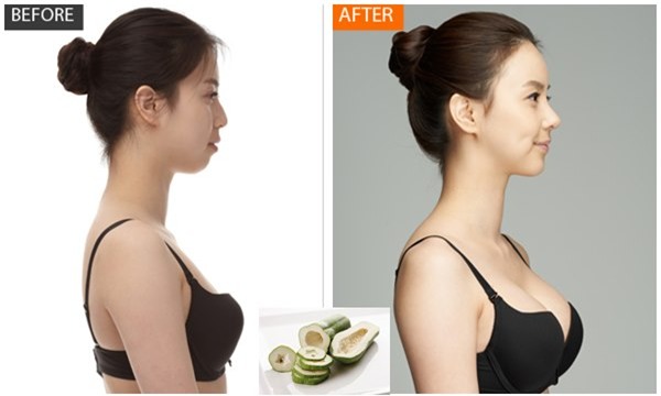 Tang ngay 5 cm vong mot chi sau vai lan uong nuoc du du xanh