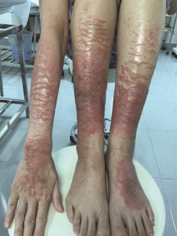 my-pham-9-blogtamsuvn-600x800