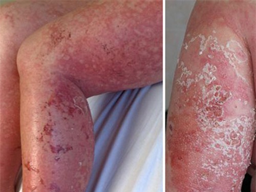 my pham-1-blogtamsuvn