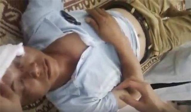 Anh Vũ Văn Hương phải khâu 7 mũi ở vùng mặt. Ảnh cắt từ clip