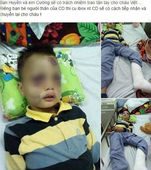 Dân mạng kêu gọi giúp đỡ cậu bé nghèo bị ngã từ sân thượng - Ảnh 1.