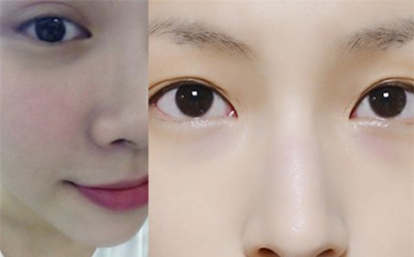 tri-mun-blogtamsuvn10