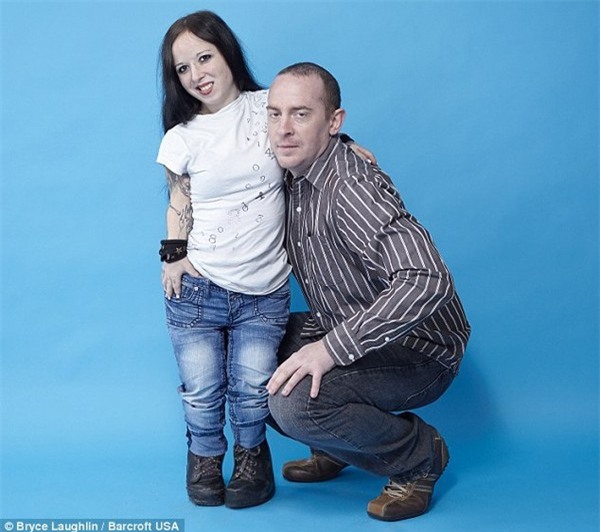 cặp đôi đũa lệch