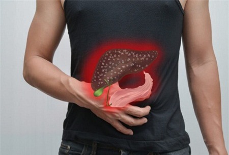 5 dấu hiệu tố bạn bị gan nhiễm mỡ - Ảnh 1.