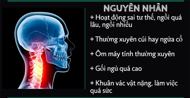 Cảnh báo căn bệnh sinh ra bách bệnh, ai cũng nên biết sớm để phòng chữa đúng cách - Ảnh 3.