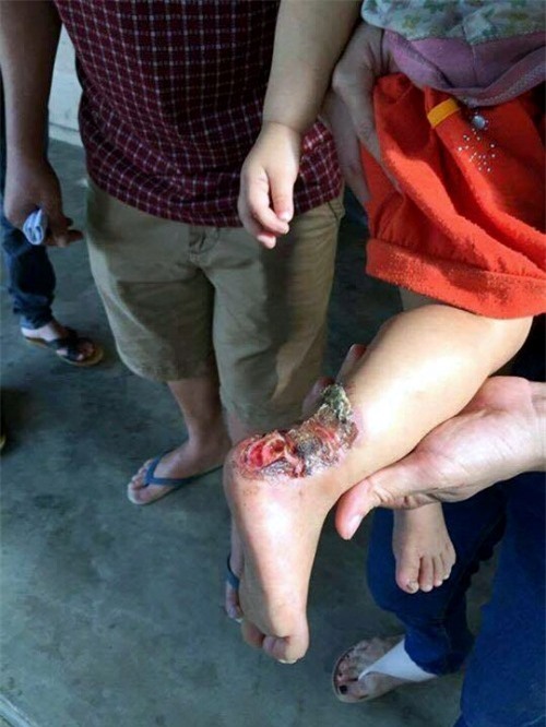 xot thuong canh nguoi me cham 3 con nho benh nang va chong nam liet giuong - 2