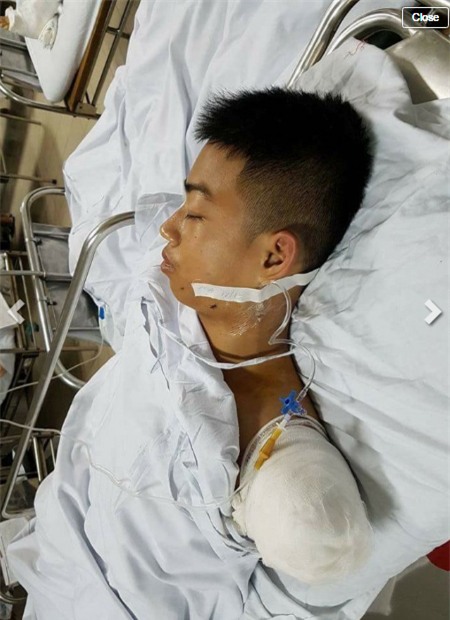 Chàng trai xứ Nghệ hy sinh cánh tay cứu bạn và câu nói đứt quãng của người cha - Ảnh 2.