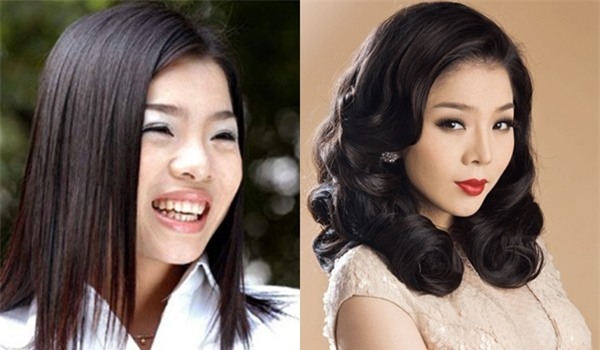 cong-khai-phau-thuat-tham-my-19