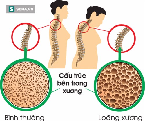 Đặt 2 ngón tay lên cổ hoặc cổ tay, đếm đến 15 để đoán căn bệnh âm thầm nhưng nguy hiểm - Ảnh 1.