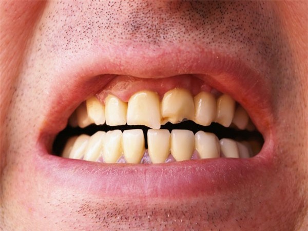 Thuoc la anh huong den ve ngoai nhu the nao? hinh anh 2