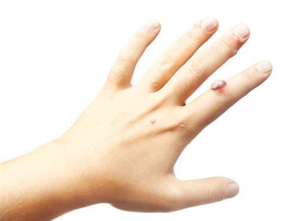 Thuoc la anh huong den ve ngoai nhu the nao? hinh anh 4